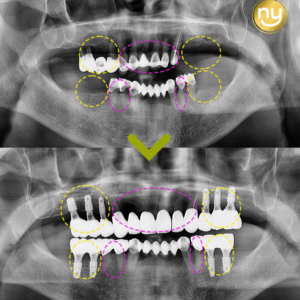 뉴욕연합-치과템플릿