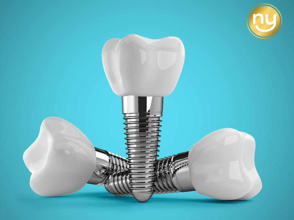 울산자기치아살리기