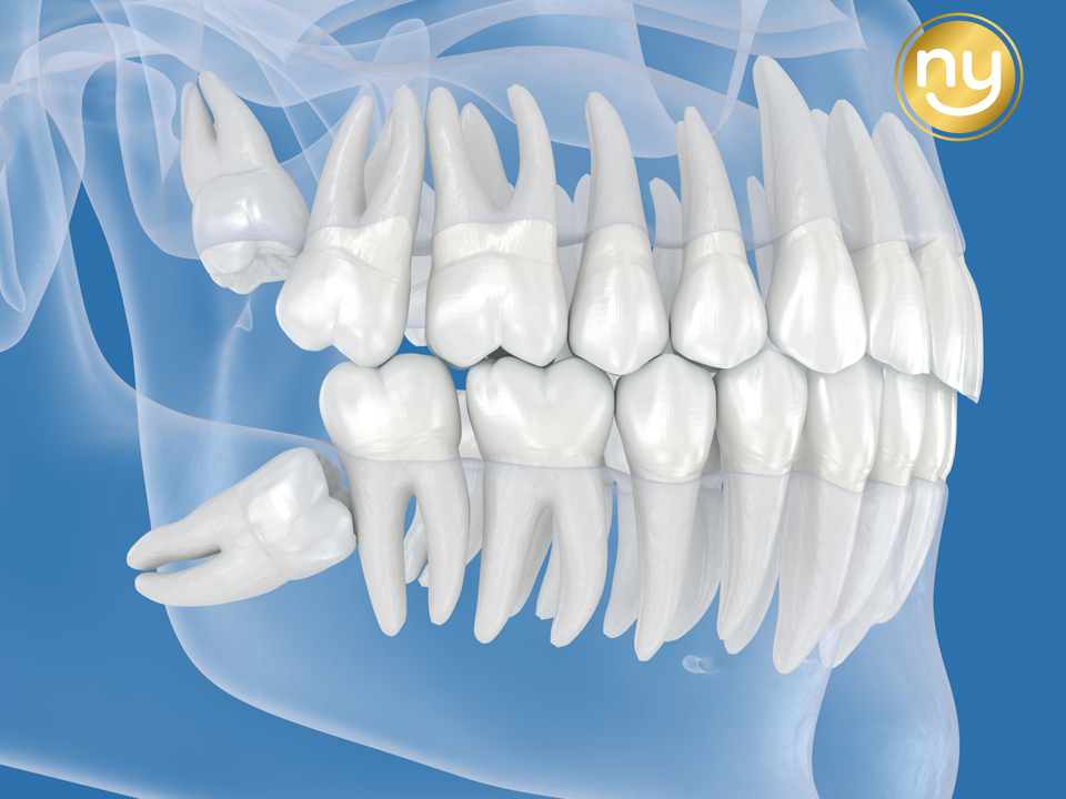 울산안아픈치과