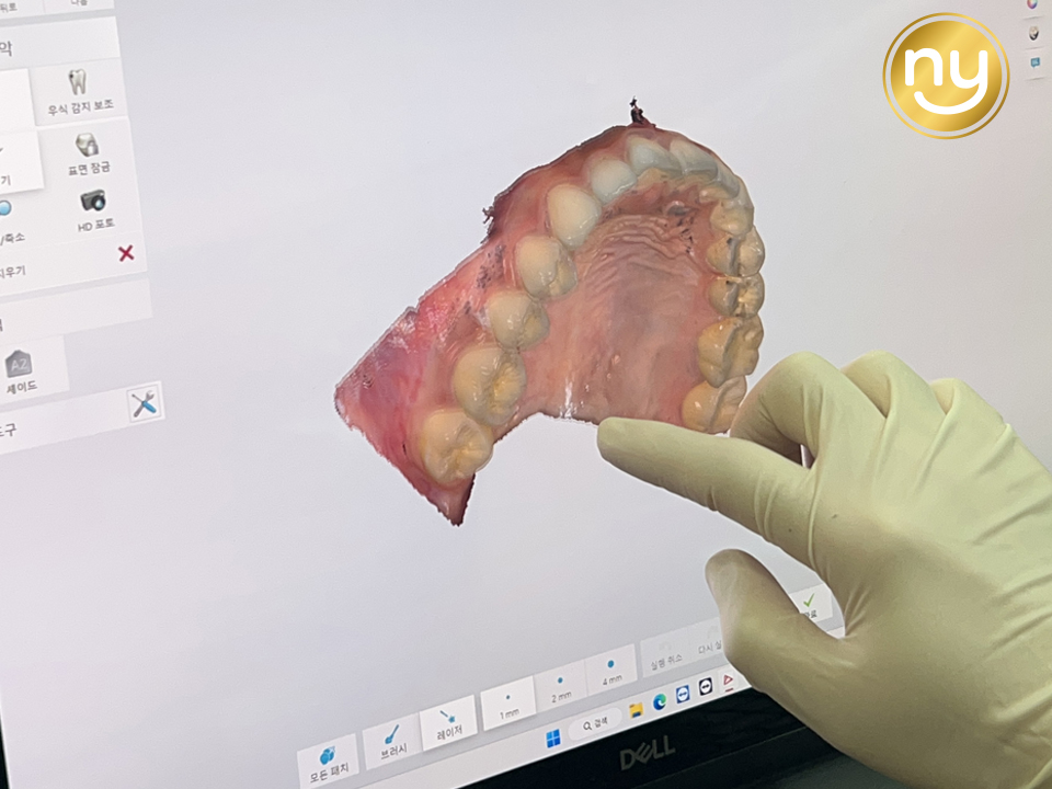 울산안아픈치과