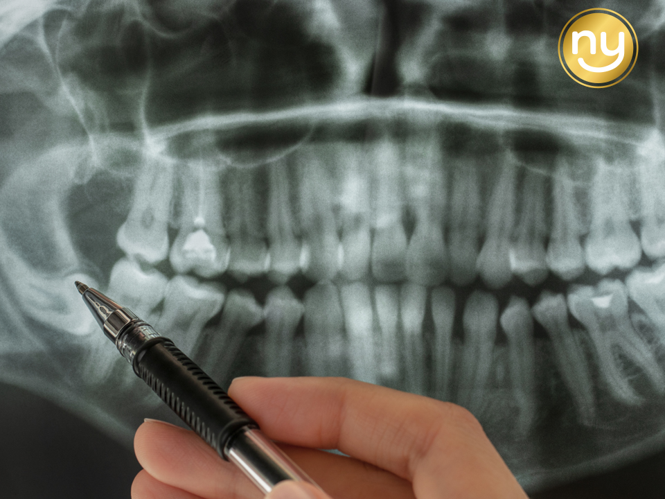 울산안아픈치과