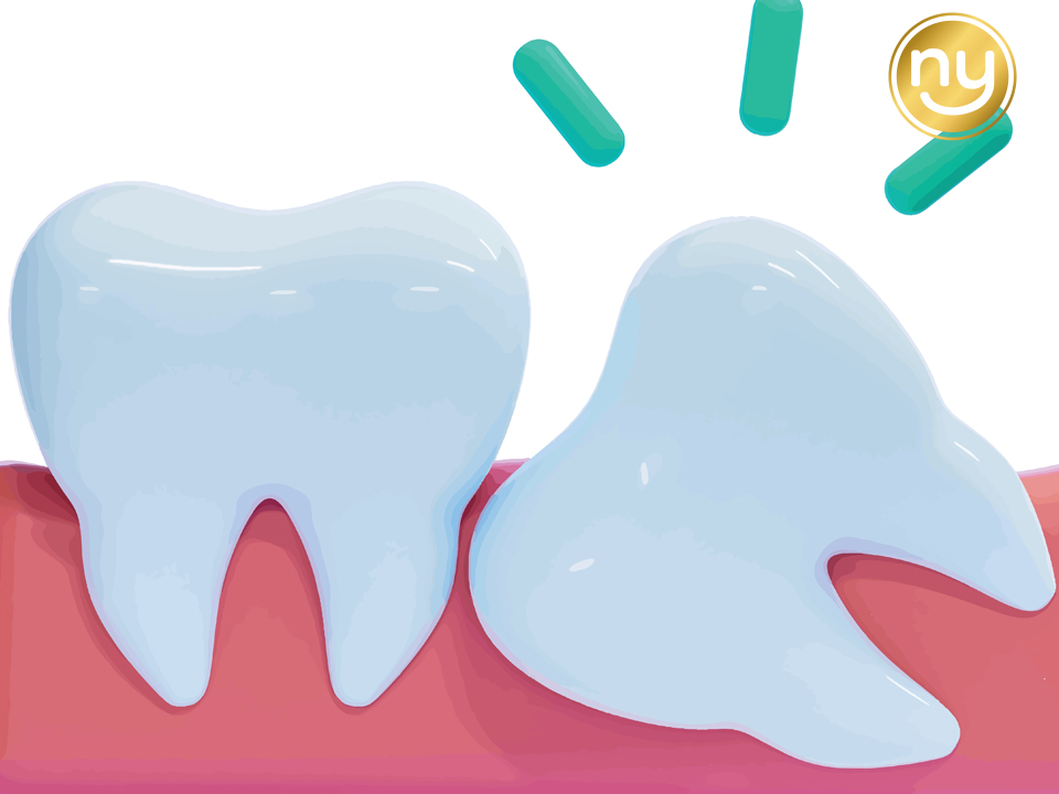 울산안아픈치과